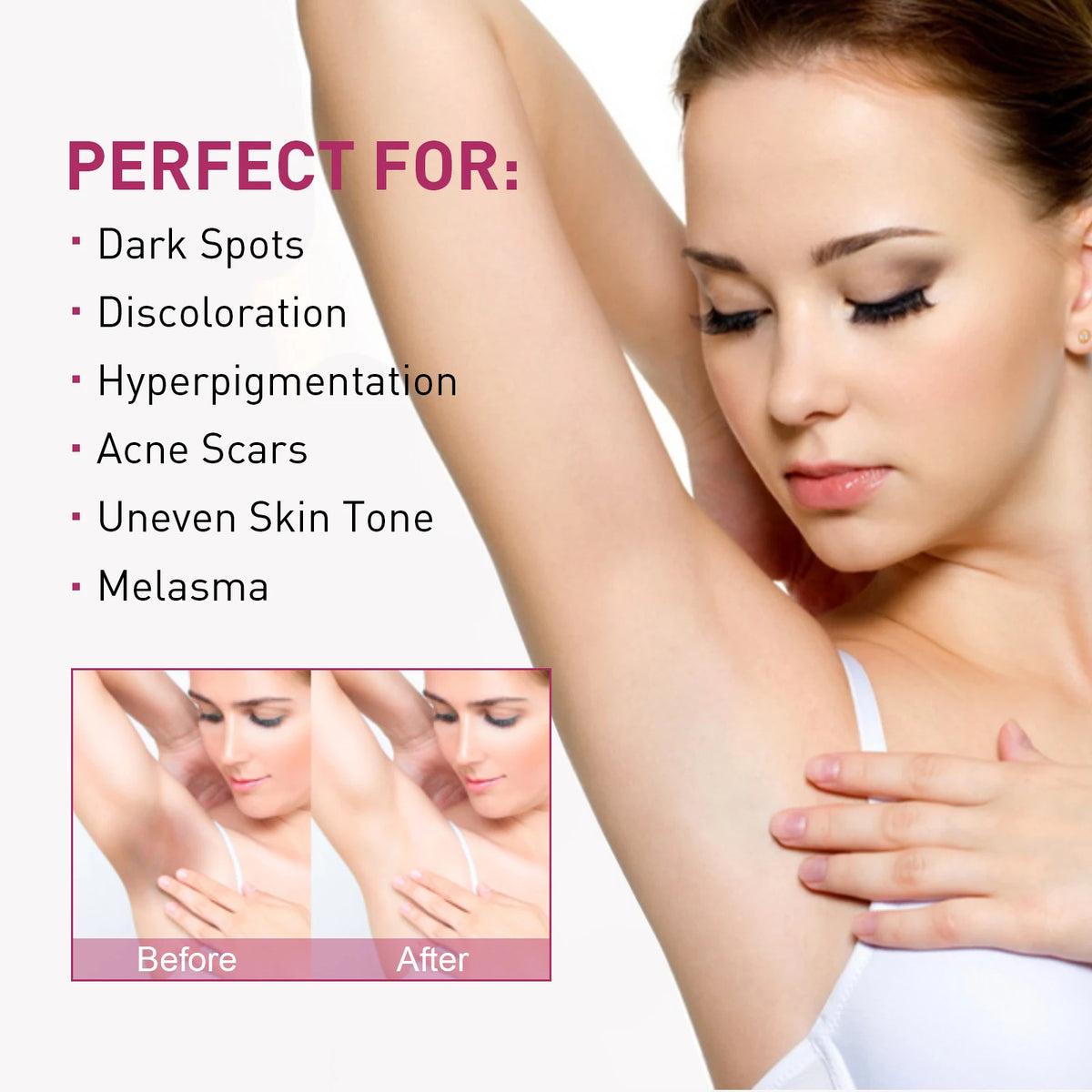 Eelhoe Body Brightening Cream – Underarm & Skin Tone Lotion Body Brightening Cream SPOT