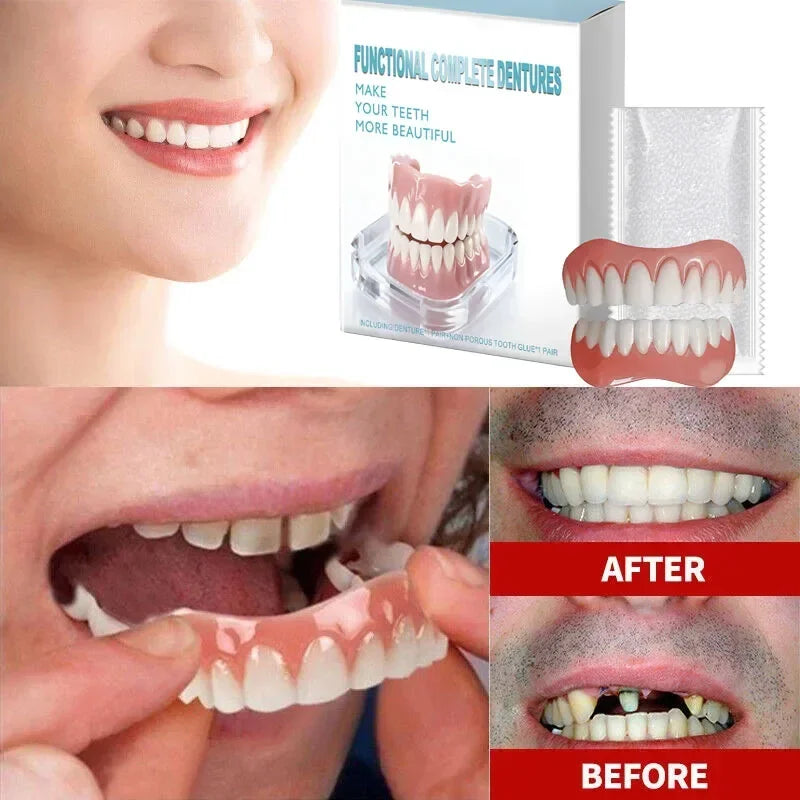 Snap-On Silicone Veneers Full Set – Upper & Lower Smile Snap-On Dental Veneers SPOT
