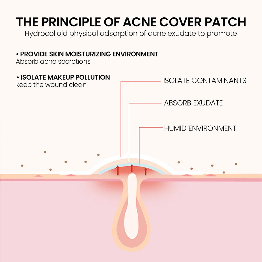 200-Pack Star Hydrocolloid Pimple Patches – Blemish Cover Hydrocolloid Pimple Patch SPOT