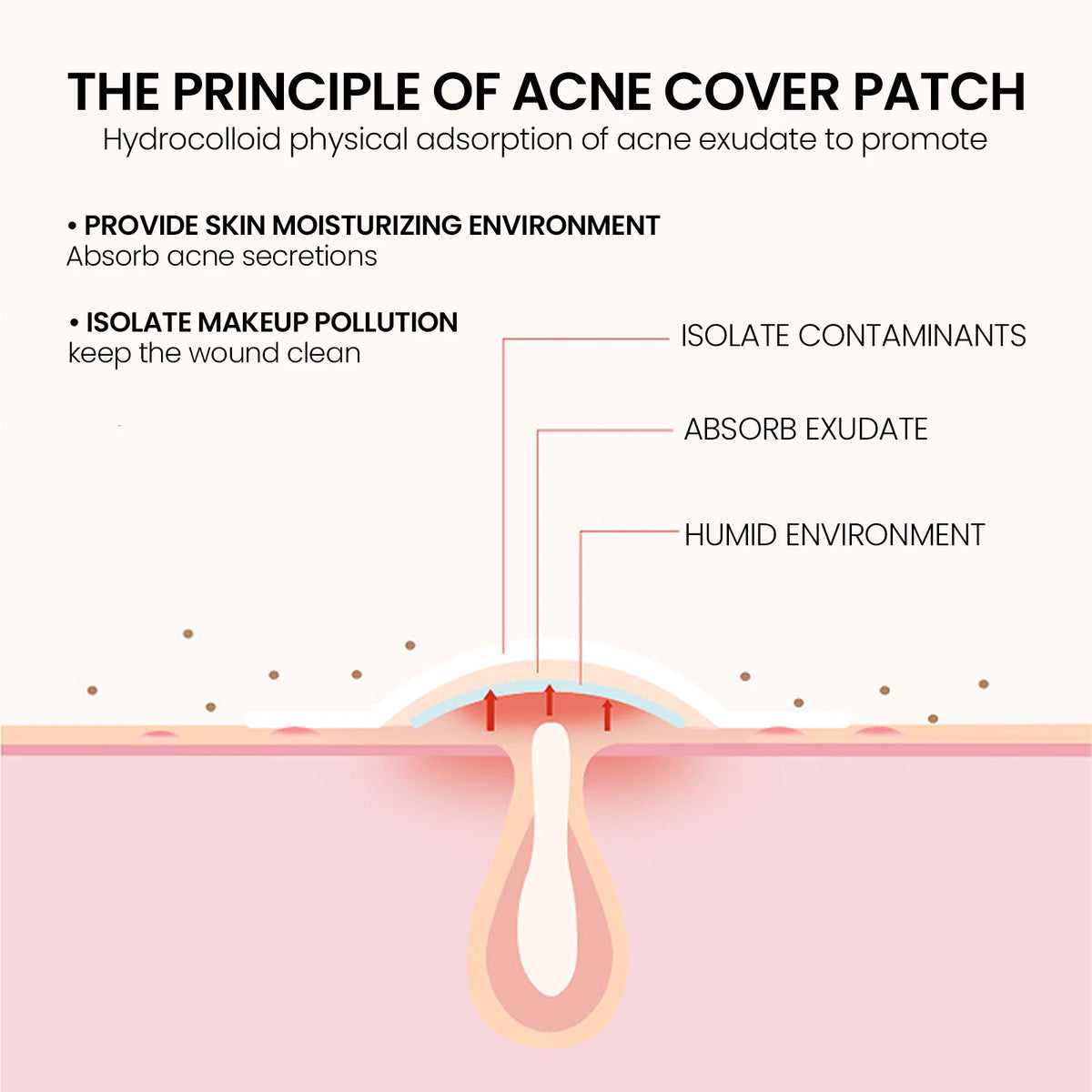 200-Pack Star Hydrocolloid Pimple Patches – Blemish Cover Hydrocolloid Pimple Patch SPOT