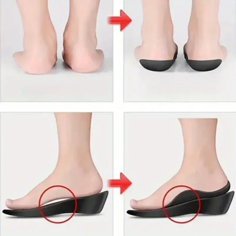 Arch Support Insoles – TPR Inserts for Men & Women | Universal Fit Arch Support Insoles SPOT