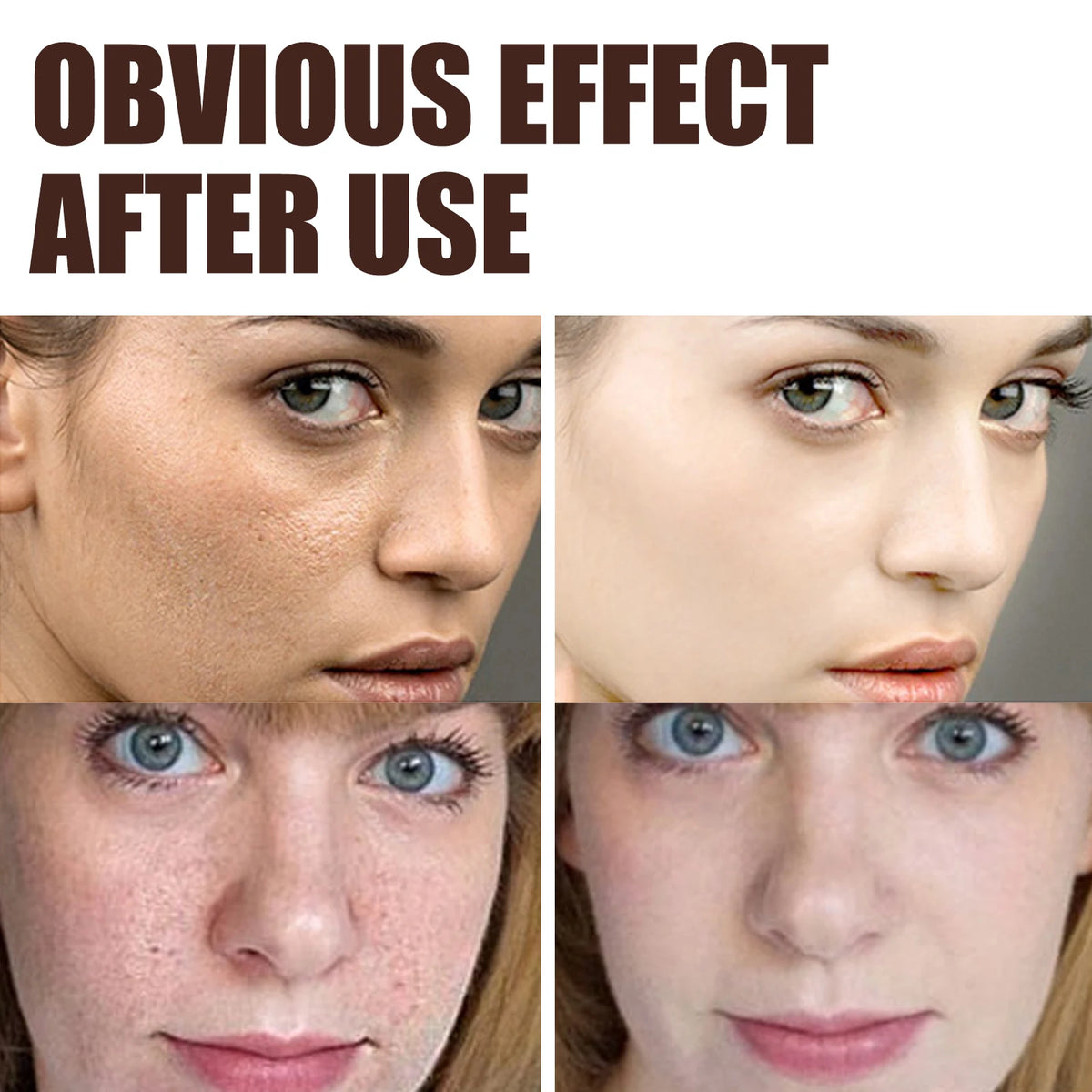 Eelhoe Double Retinol Face Cream – Firming & Brightening 30g Retinol Face Cream SPOT