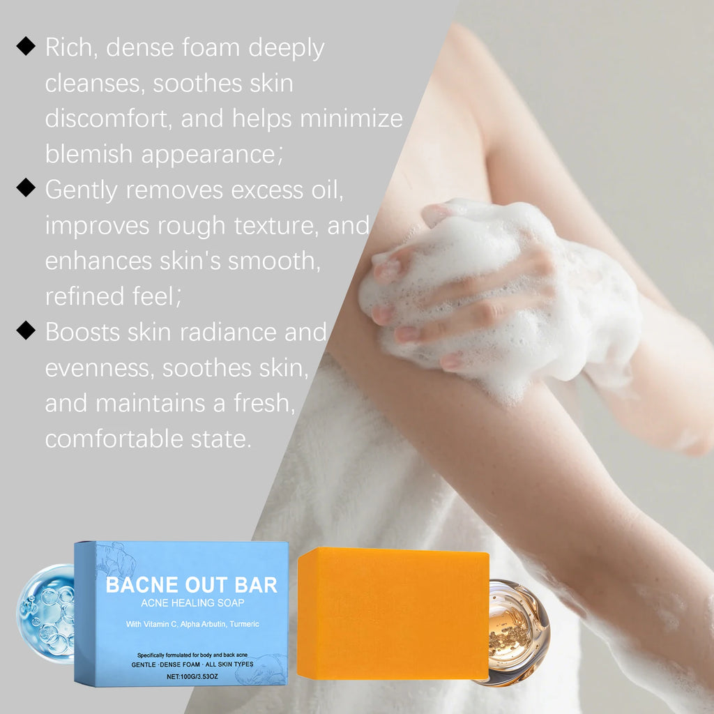 Hoygi Brightening Exfoliating Facial & Body Soap – 100g Bar Cleansing Soap Bar SPOT