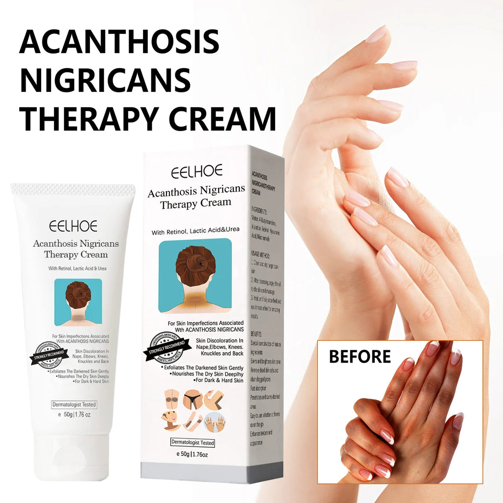 EELHOE Brightening Body Cream – Niacinamide & Retinol 50g Brightening Body Cream SPOT