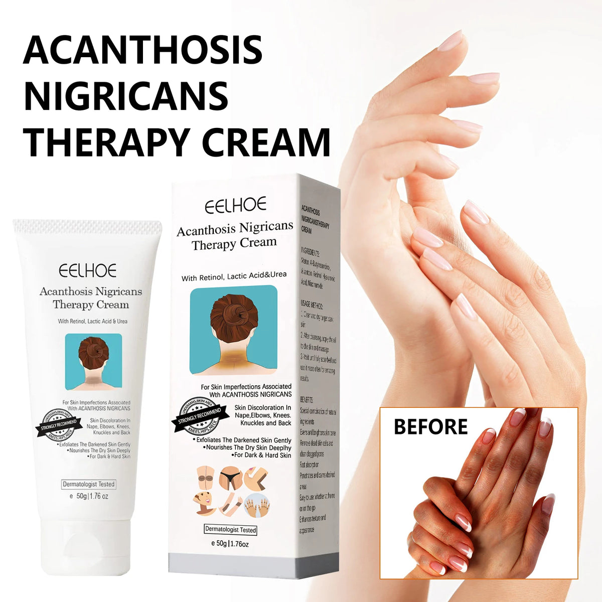 EELHOE Brightening Body Cream – Niacinamide & Retinol 50g Brightening Body Cream SPOT
