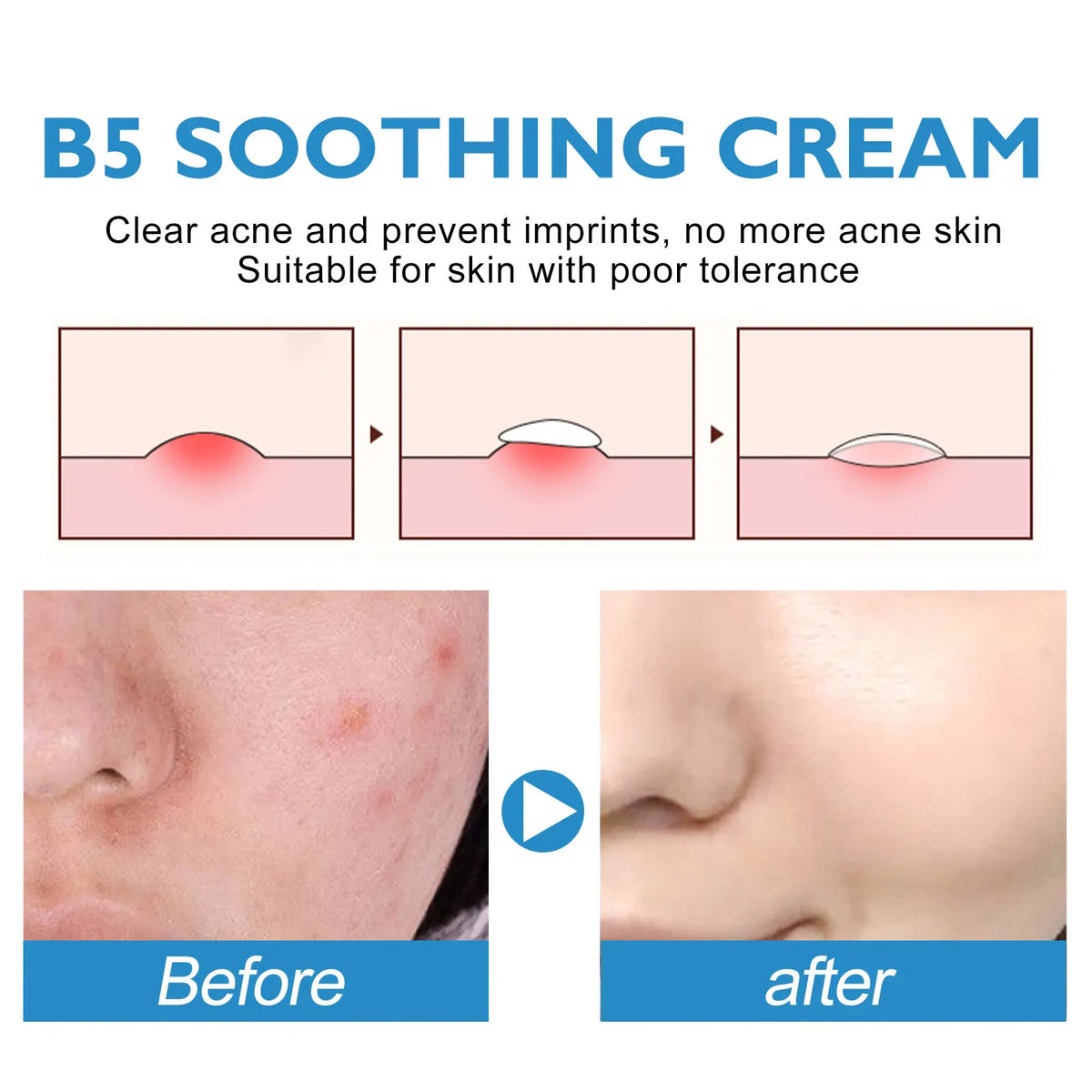 Eelhoe B5 Repair Face Cream – Vitamin B5 & Centella Asiatica Face Repair Cream SPOT