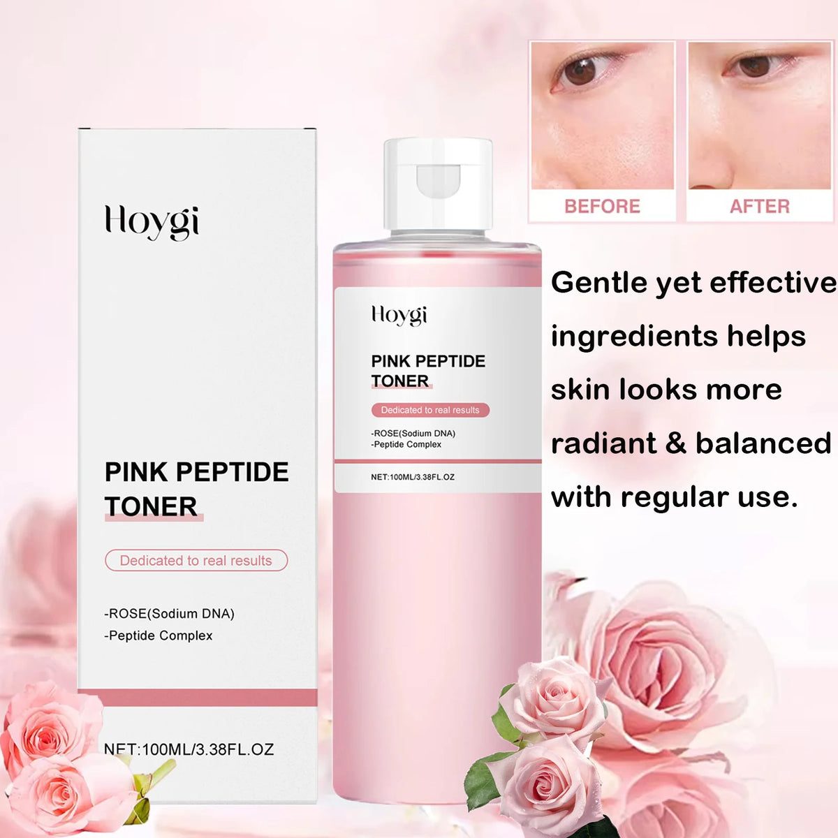Hoygi Rose Peptide Toner – Brightening & Hydrating | 100ml Facial Toner SPOT