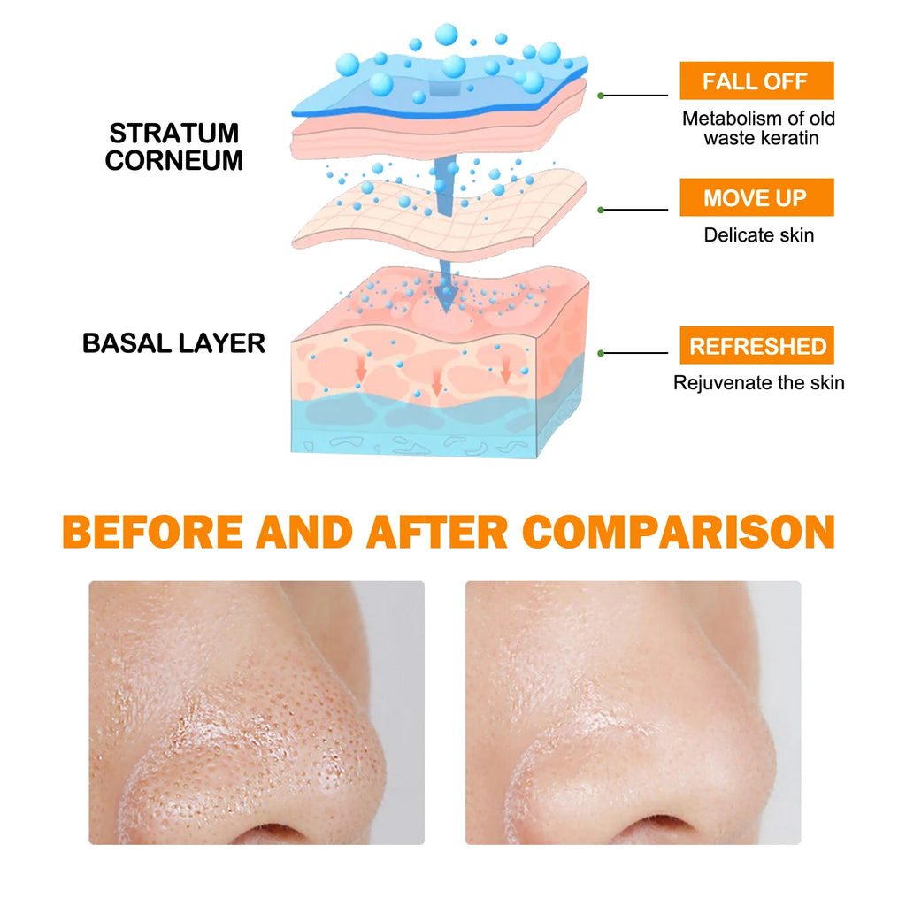 Hoygi Orange Enzyme Exfoliating Brightening Gel 50g Exfoliating Face Gel SPOT