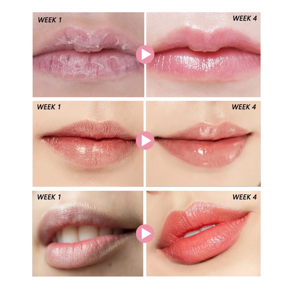 Eelhoe Peach Lip Scrub – Moisturizing & Smoothing, 30g Lip Scrub SPOT