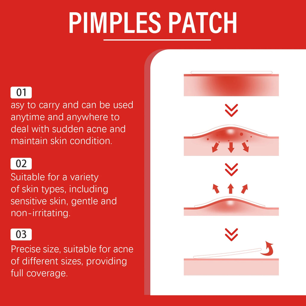 240-Pack Salicylic Acid Blemish Patches – Fun Shapes, All Skin Blemish Patches SPOT
