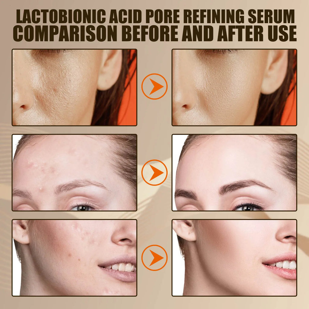 Eelhoe Lactic Acid Pore Minimizing Face Serum 30ml Face Serum SPOT