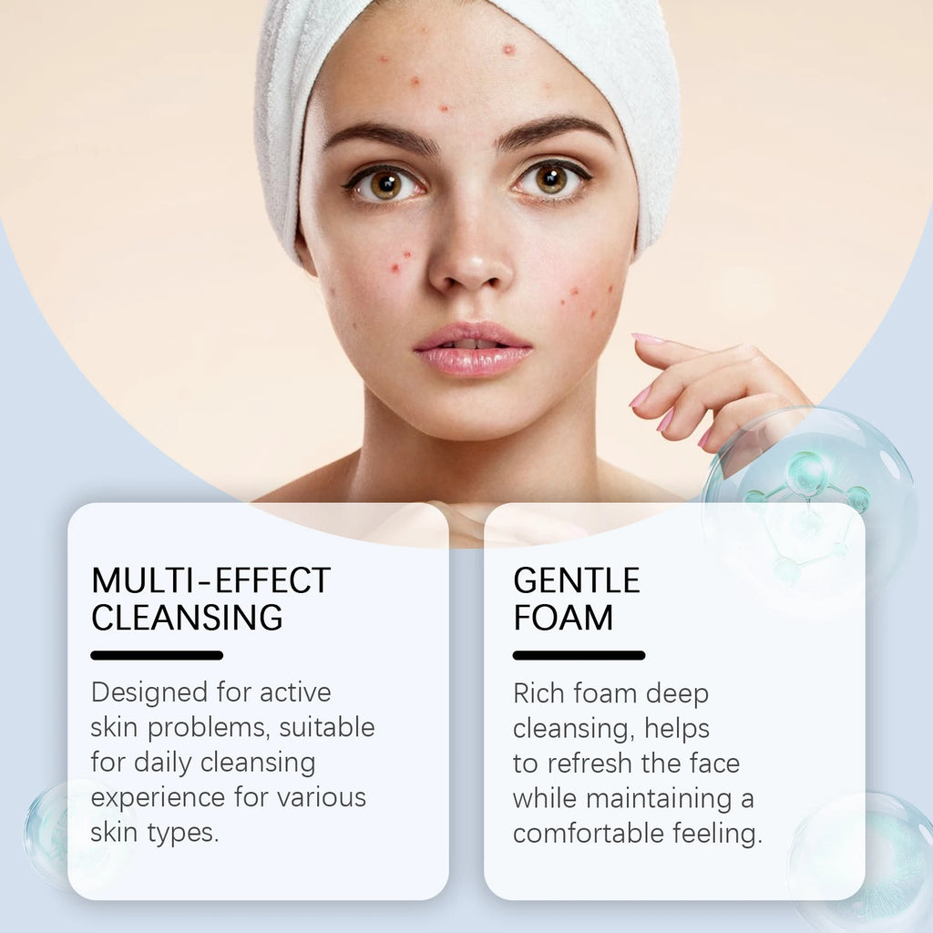 Salicylic Acid Face Wash – Oil Control & Pore Cleanser Facial Cleanser SPOT