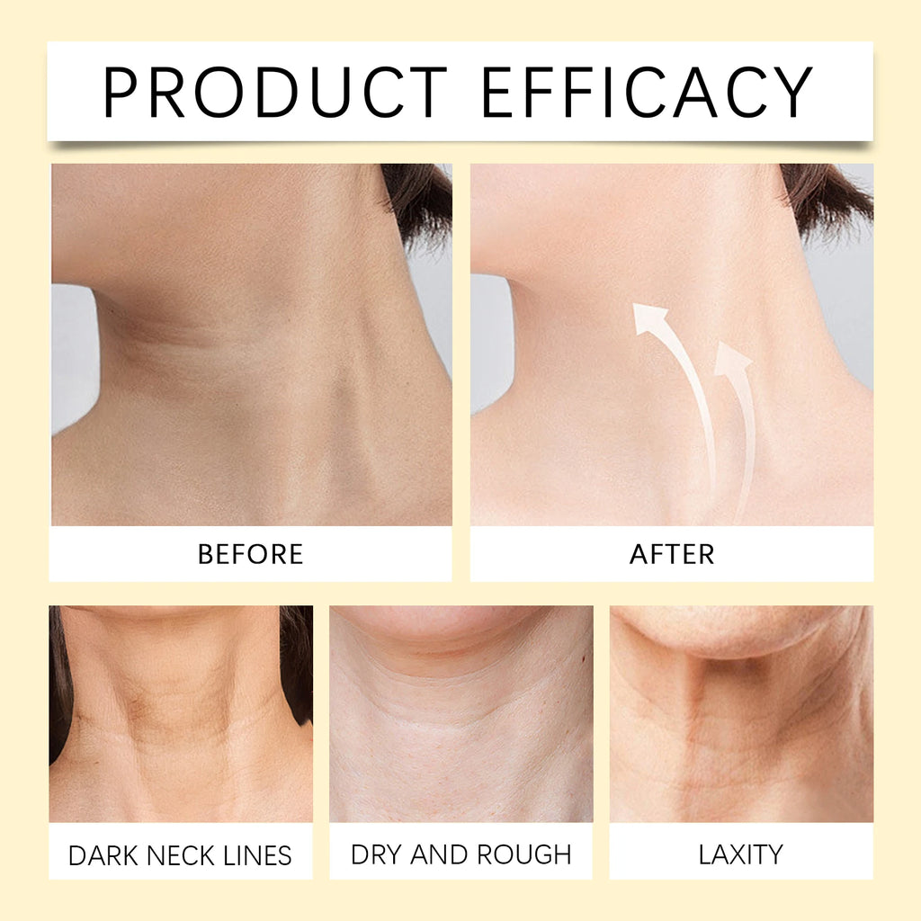 Eelhoe Bee-Venom Neck Cream Stick – Collagen Lift & Firm Neck Firming Cream SPOT