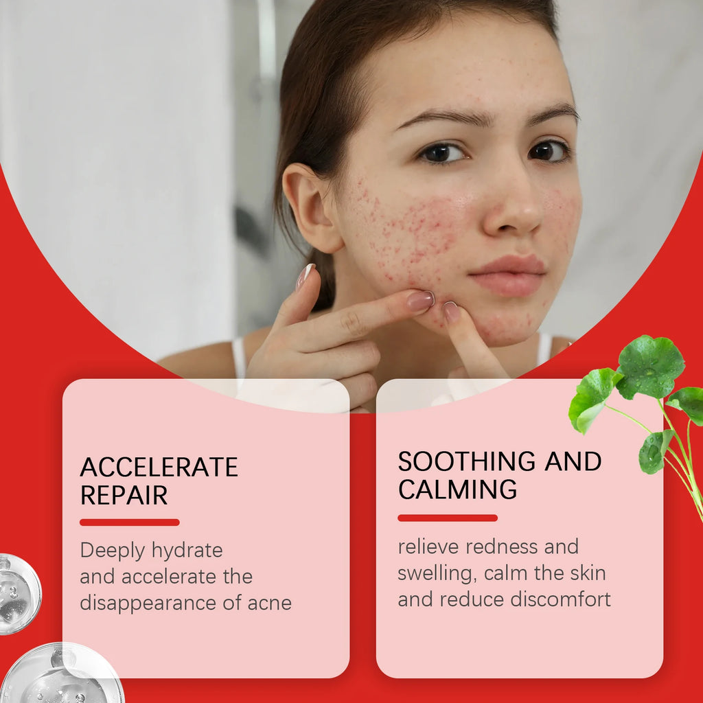 240-Pack Salicylic Acid Blemish Patches – Fun Shapes, All Skin Blemish Patches SPOT
