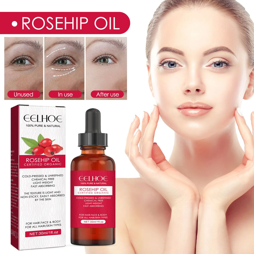 EELHOE Rosehip Facial Oil – Moisturizing & Firming 30ml Facial Skincare Oil SPOT