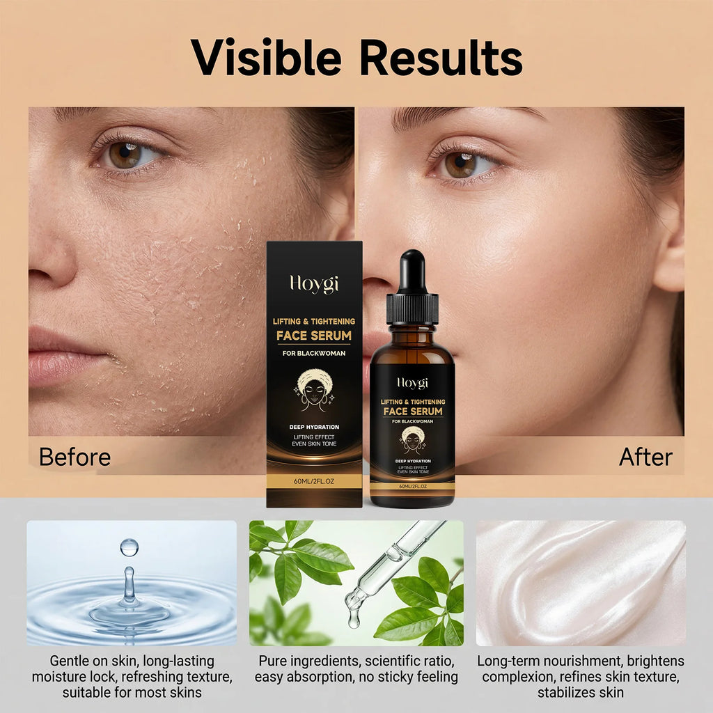 Niacinamide Hyaluronic Acid Face Serum – Firming & Brightening Face Serum SPOT