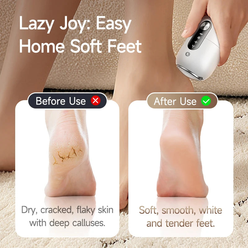 Electric Foot Sander – Rechargeable Foot Exfoliator & File Electric Foot File SPOT