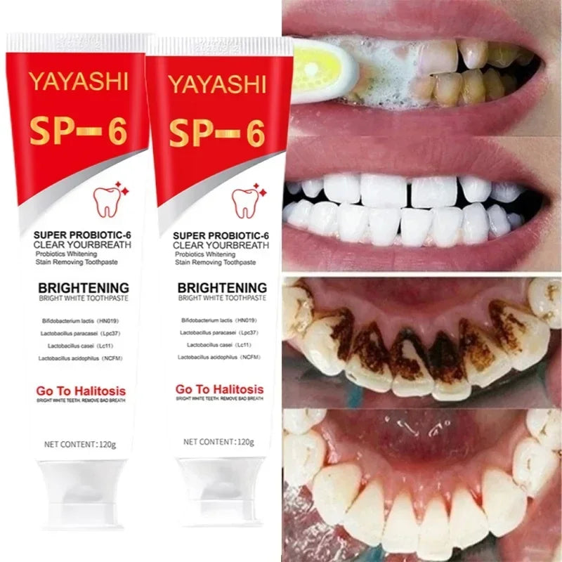 Eelhoe SP-6 Probiotic Whitening Toothpaste 120g – Stain Removal Whitening Toothpaste SPOT
