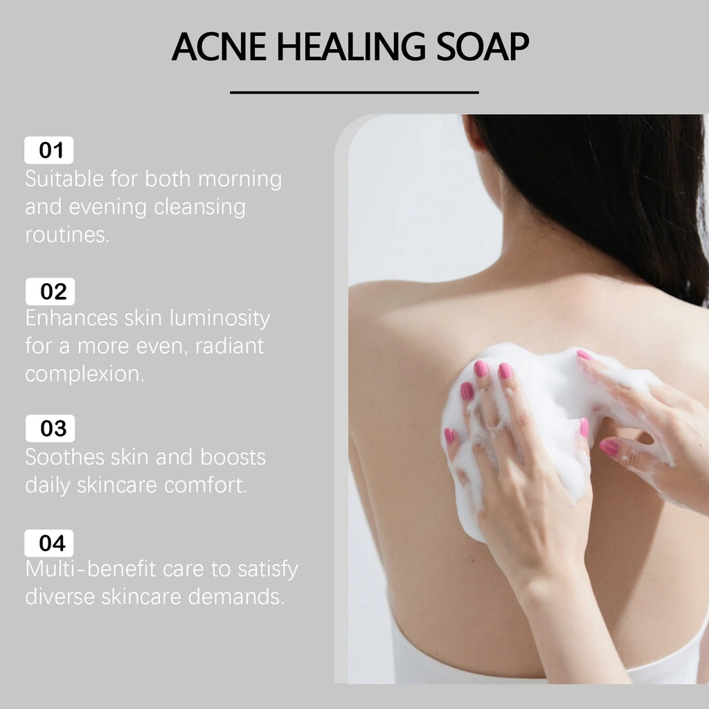 Hoygi Brightening Exfoliating Facial & Body Soap – 100g Bar Cleansing Soap Bar SPOT