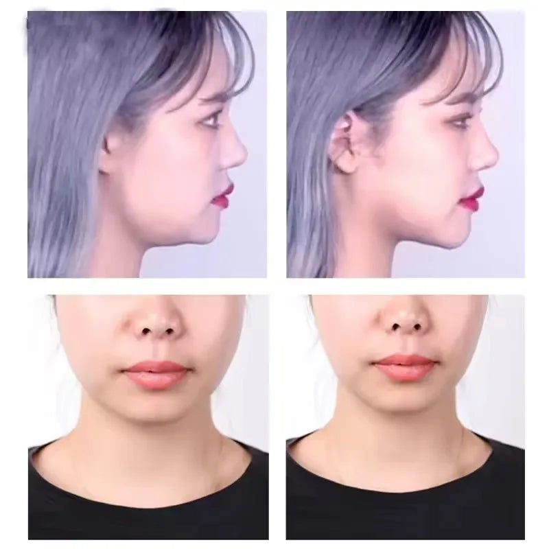 V-Shape Face Lifting Tape – Invisible Skin Tightening Stickers Face Lifting Tape SPOT