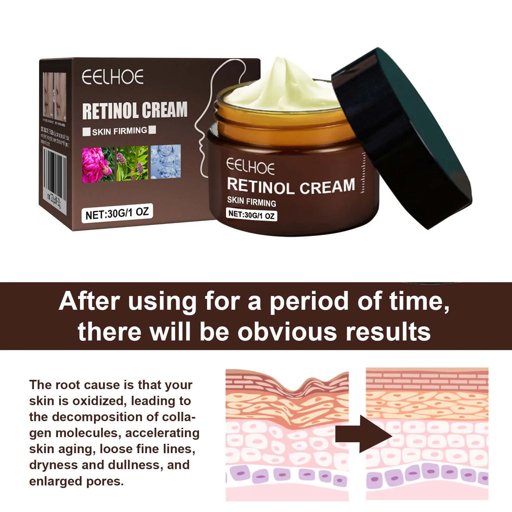 Eelhoe Double Retinol Face Cream – Firming & Brightening 30g Retinol Face Cream SPOT