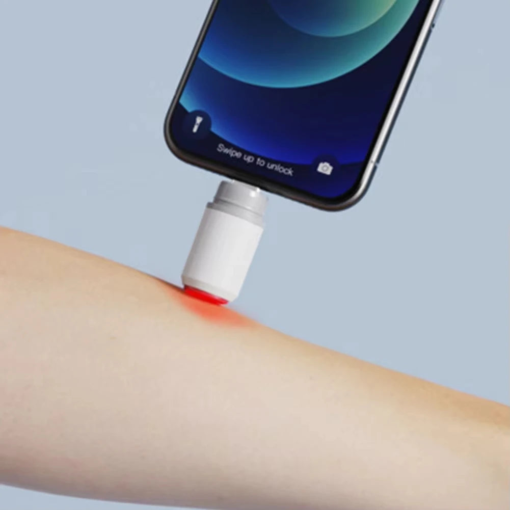 Electronic Anti-Itch Pen – Portable Insect Bite Relief Device Anti-Itch Device SPOT