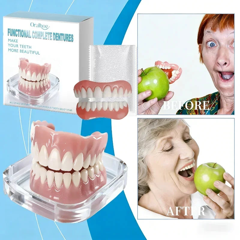 Snap-On Silicone Veneers Full Set – Upper & Lower Smile Snap-On Dental Veneers SPOT