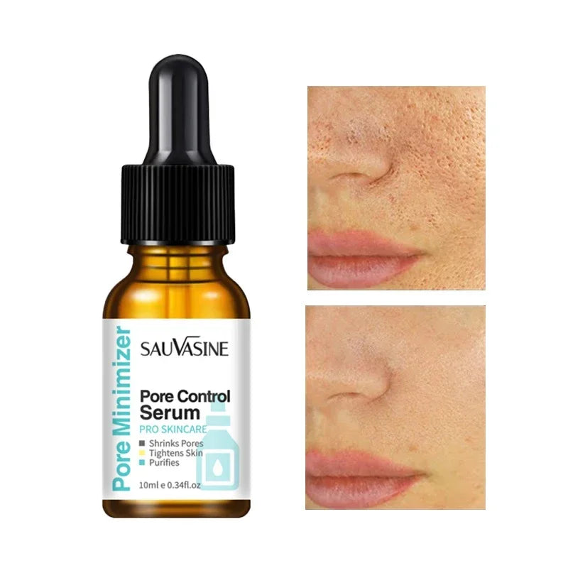 Eelhoe Pore Minimizing Face Serum – Tightening & Moisturizing Face Serum SPOT