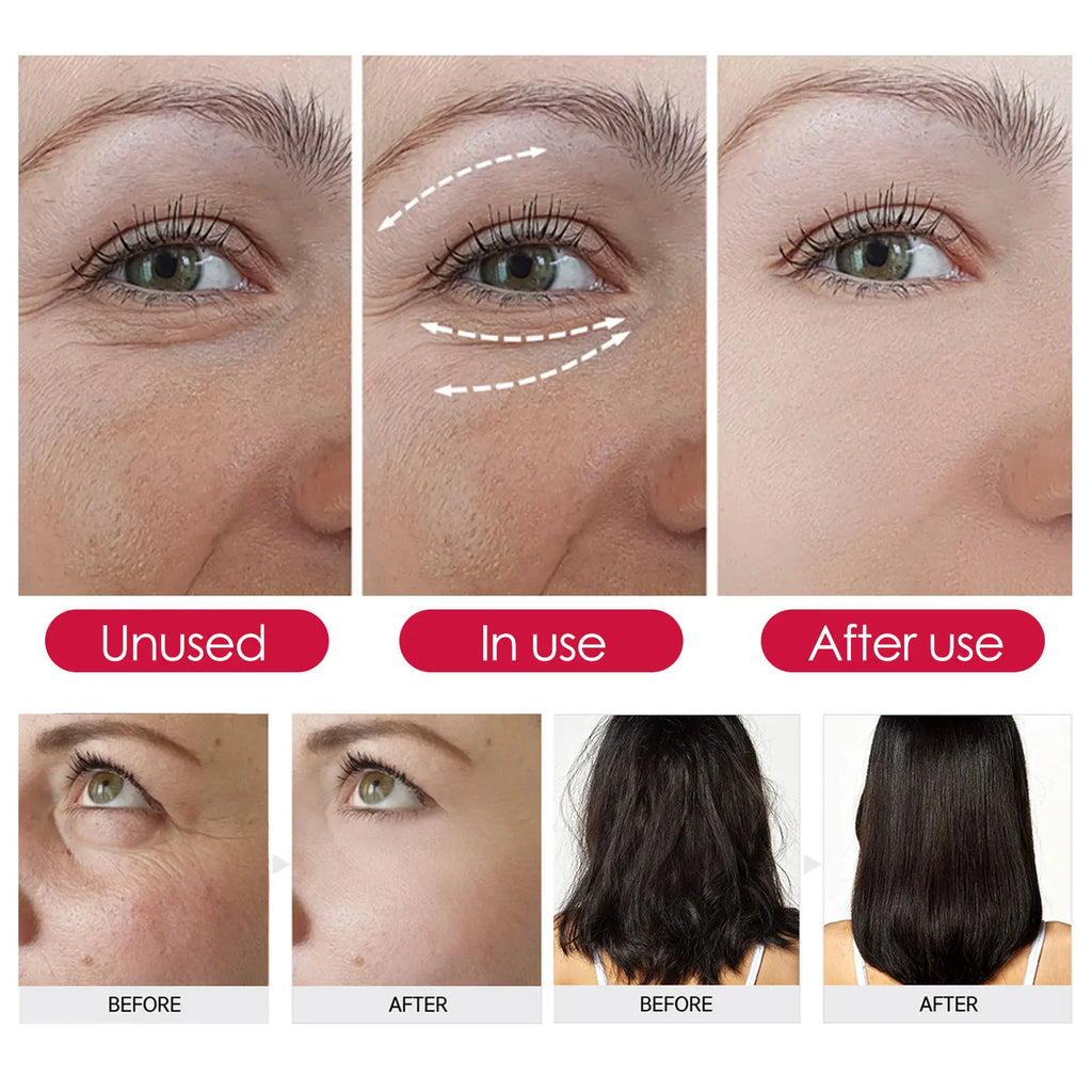 EELHOE Rosehip Facial Oil – Moisturizing & Firming 30ml Facial Skincare Oil SPOT