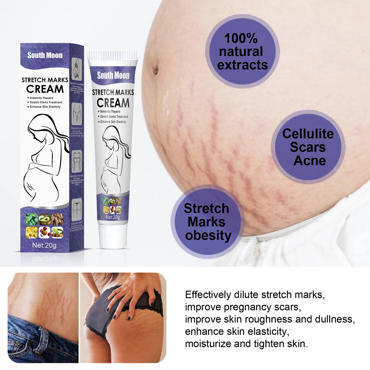 South Moon Stretch Mark Cream – Firming & Moisturizing Skin Care Body Firming Cream SPOT