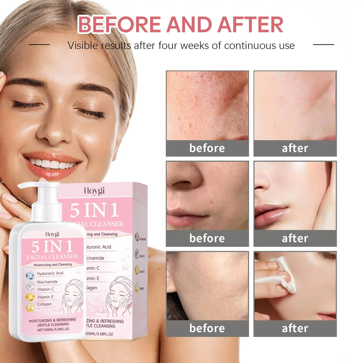 Hoygi 5-in-1 Hydrating Foam Facial Cleanser – 100ml Facial Cleanser SPOT