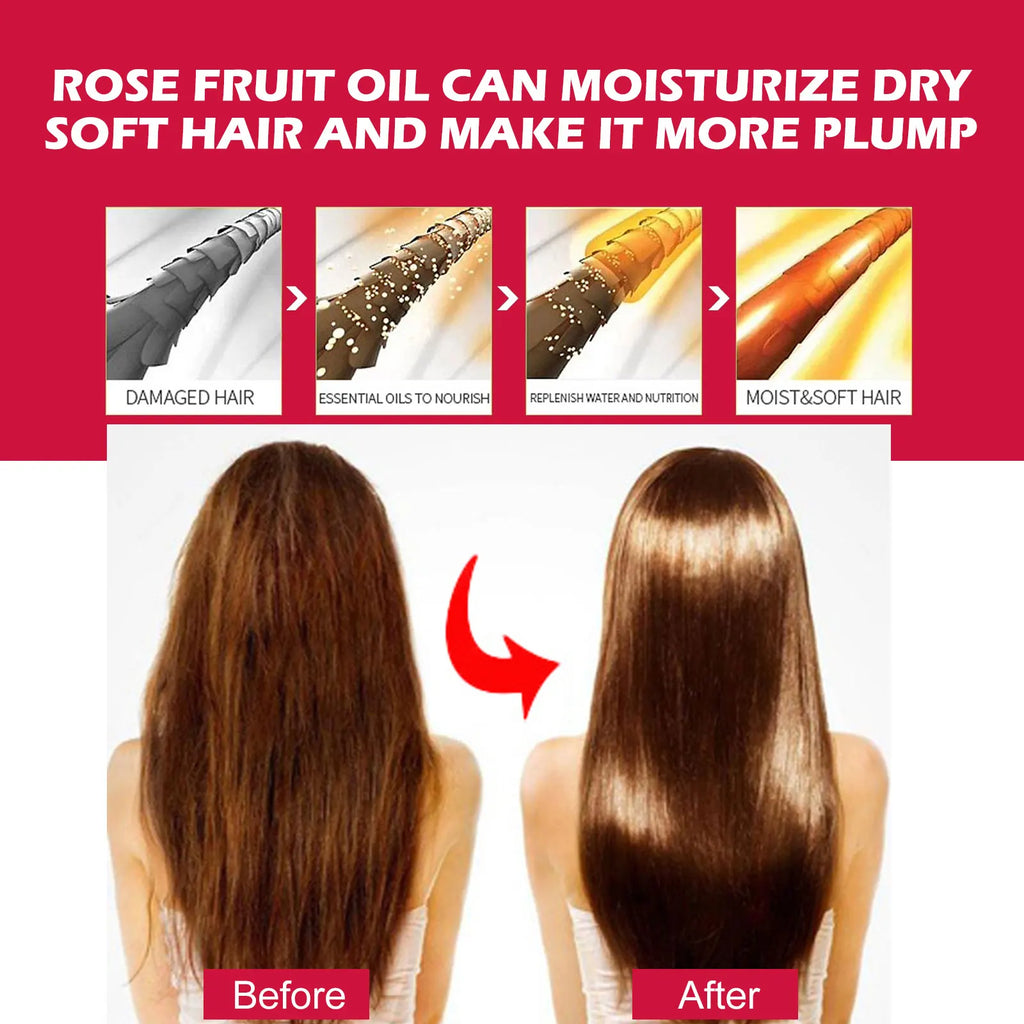 EELHOE Rosehip Facial Oil – Moisturizing & Firming 30ml Facial Skincare Oil SPOT