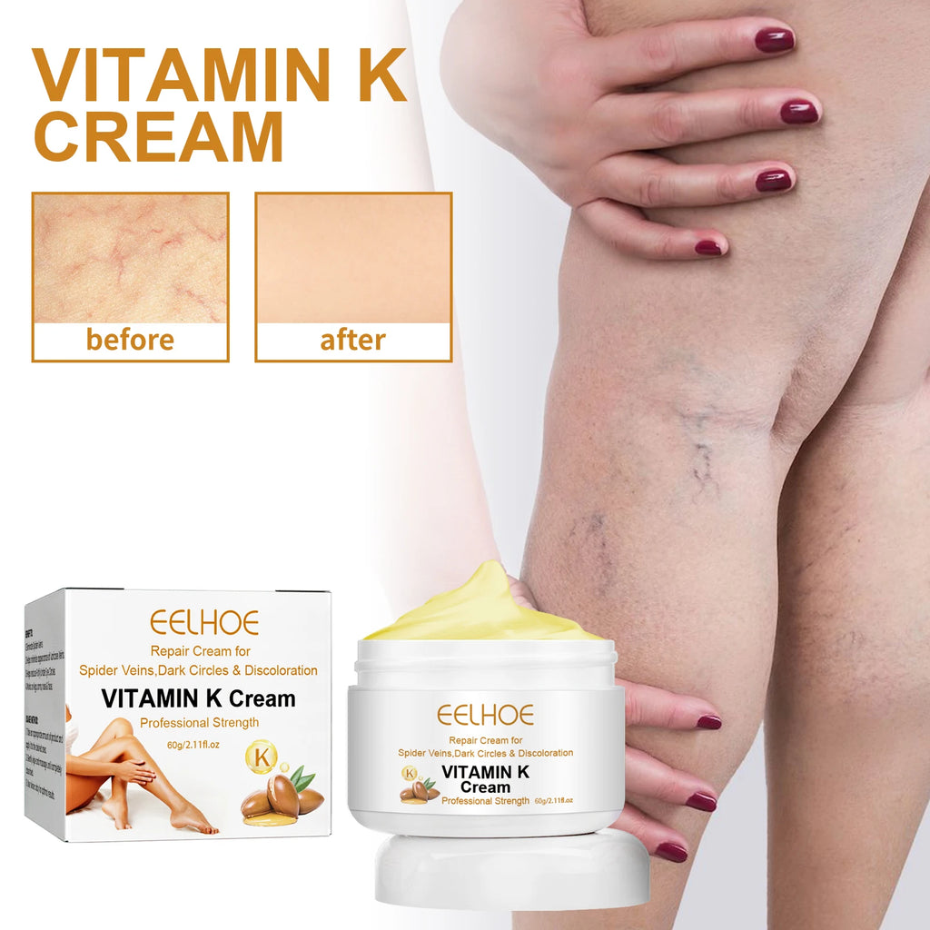 Eelhoe Vitamin K Cream – Leg & Skin Massage Cream 60g Vitamin K Skin Cream SPOT