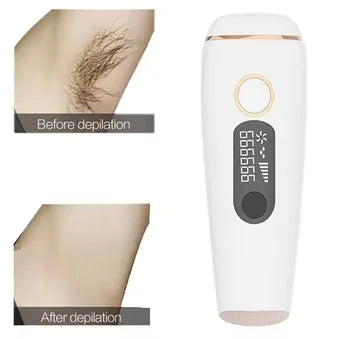 DUTRIEUX Mini IPL Hair Removal Device | 990K Flashes, 5 Levels IPL Hair Removal Device SPOT