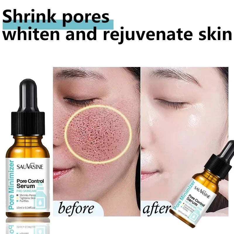Eelhoe Pore Minimizing Face Serum – Tightening & Moisturizing Face Serum SPOT