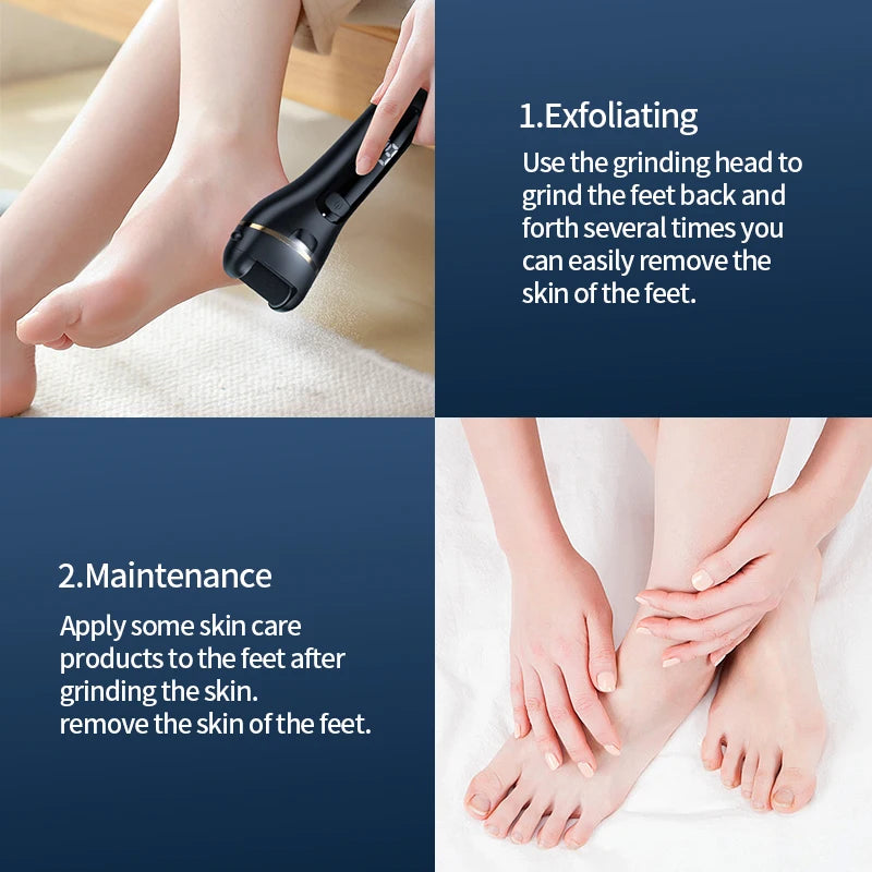 Rechargeable Electric Callus Remover – USB Foot Grinder Electric Callus Remover SPOT