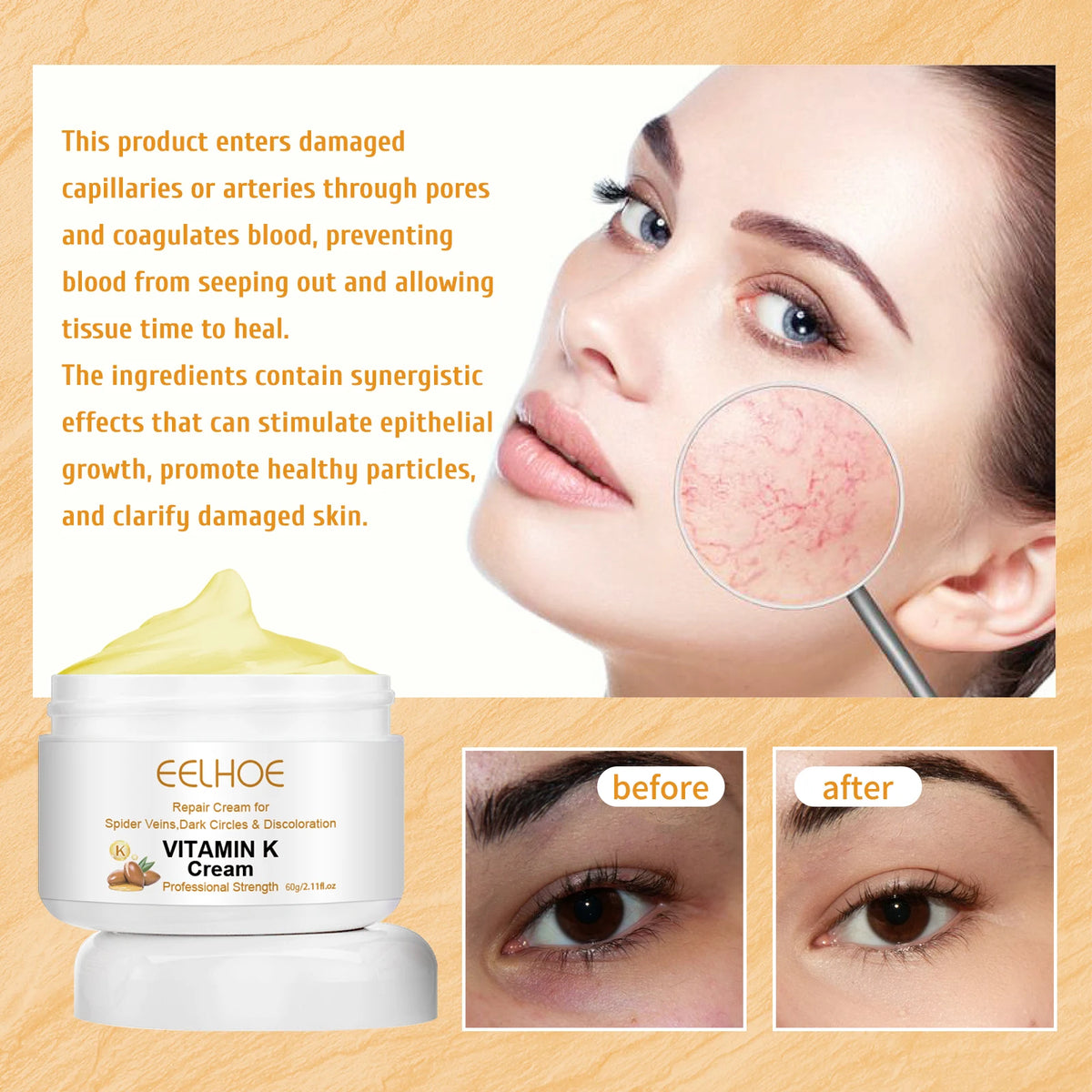 Eelhoe Vitamin K Cream – Leg & Skin Massage Cream 60g Vitamin K Skin Cream SPOT