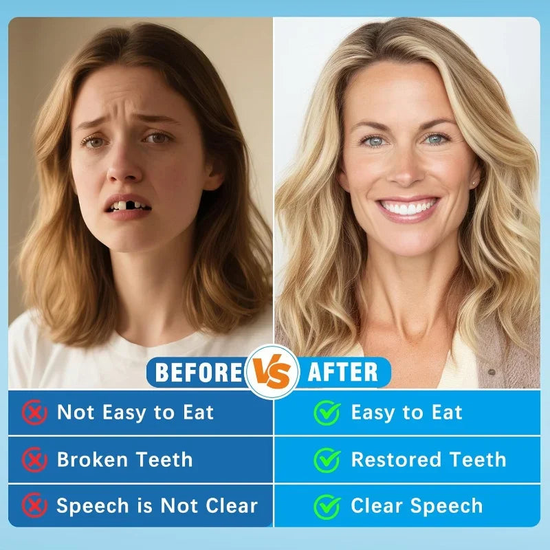 Custom Silicone Dentures – Full Mouth Natural-Look Teeth Silicone Dentures SPOT