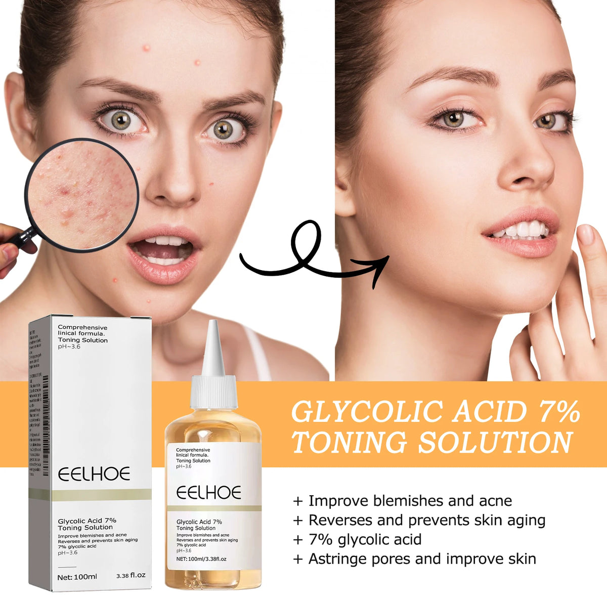 Eelhoe Glycolic Acid 7% Toner – Exfoliate, Brighten & Smooth Exfoliating Toner SPOT