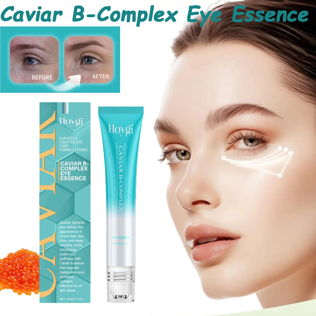 Hoygi Caviar B-Complex Eye Serum – Brighten & Firm Eye Serum SPOT