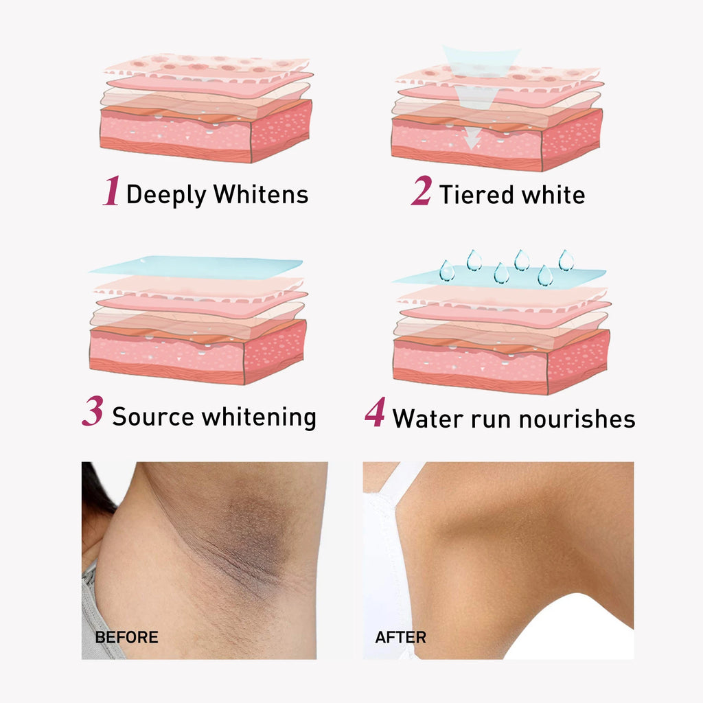 Eelhoe Body Brightening Cream – Underarm & Skin Tone Lotion Body Brightening Cream SPOT