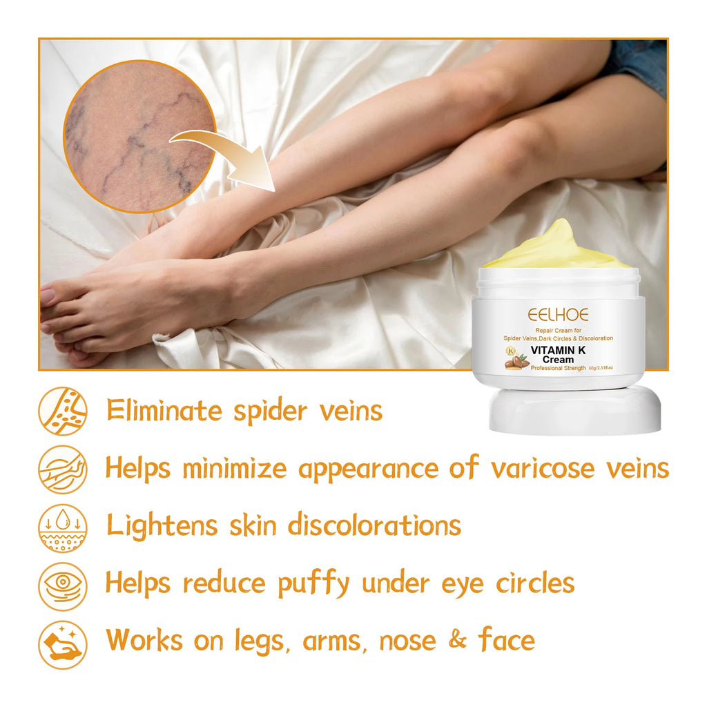 Eelhoe Vitamin K Cream – Leg & Skin Massage Cream 60g Vitamin K Skin Cream SPOT