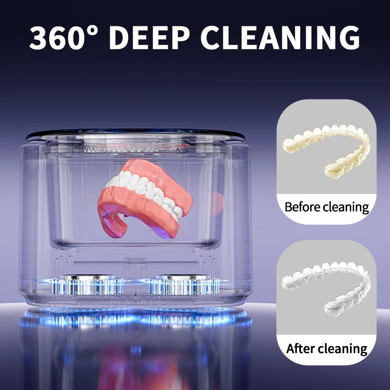 Portable 45kHz Ultrasonic Cleaner UV – Dentures, Retainers & Jewelry Ultrasonic Cleaner SPOT