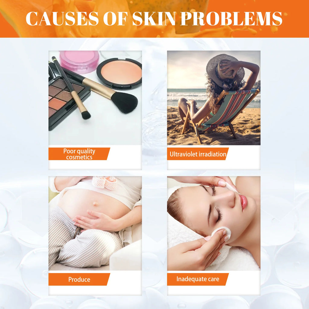 Papaya Brightening Day & Night Face Cream Set – Skin Tone Corrector Brightening Face Cream SPOT