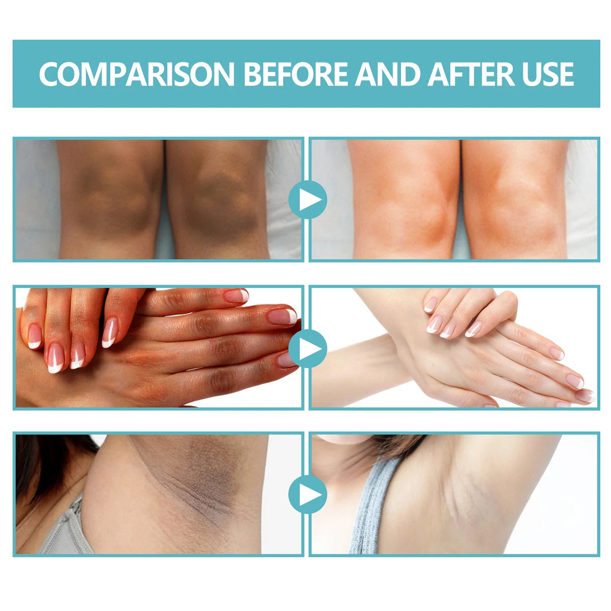 EELHOE Brightening Body Cream – Niacinamide & Retinol 50g Brightening Body Cream SPOT