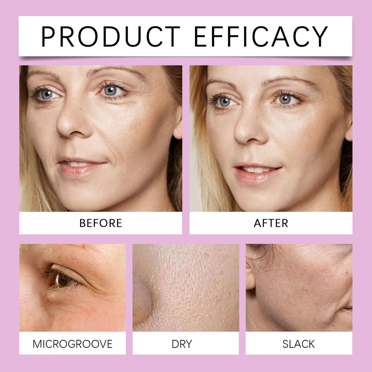 EELHOE Collagen Lifting Facial Serum | Ceramide Ampoule Essence Facial Serum SPOT